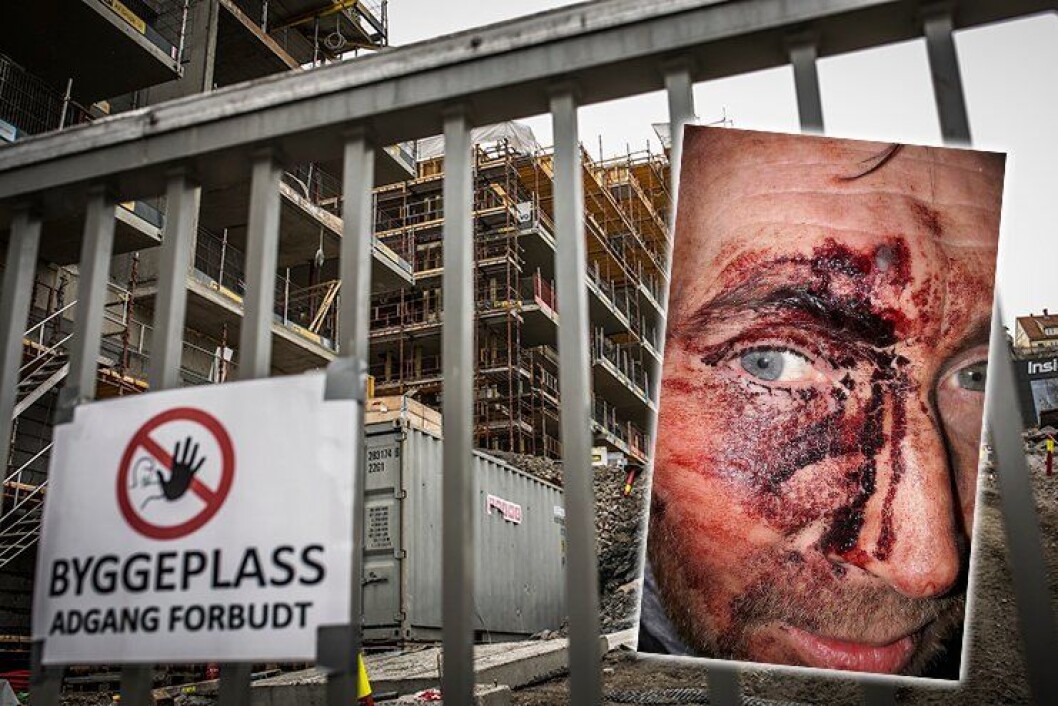ANGREPET: Da politimannen ankom byggeplassen i Kværnerbyen i Oslo, der en innbruddsalarm hadde gått, ble han slått med en planke med spiker. FOTO: Torkjell Trædal/privat ANGREPET: Da politimannen ankom byggeplassen i Kværnerbyen i Oslo, der en innbruddsalarm hadde gått, ble han slått med en planke med spiker. FOTO: Torkjell Trædal/privat