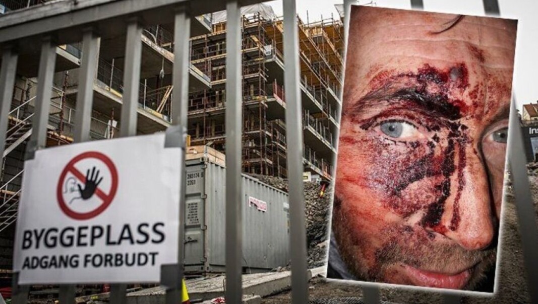 SLÅTT MED SPIKERPLANKE: Hundefører Morten Ingolf Johansen var centimeter unna å bli blind. SLÅTT MED SPIKERPLANKE: Hundefører Morten Ingolf Johansen var centimeter unna å bli blind.
