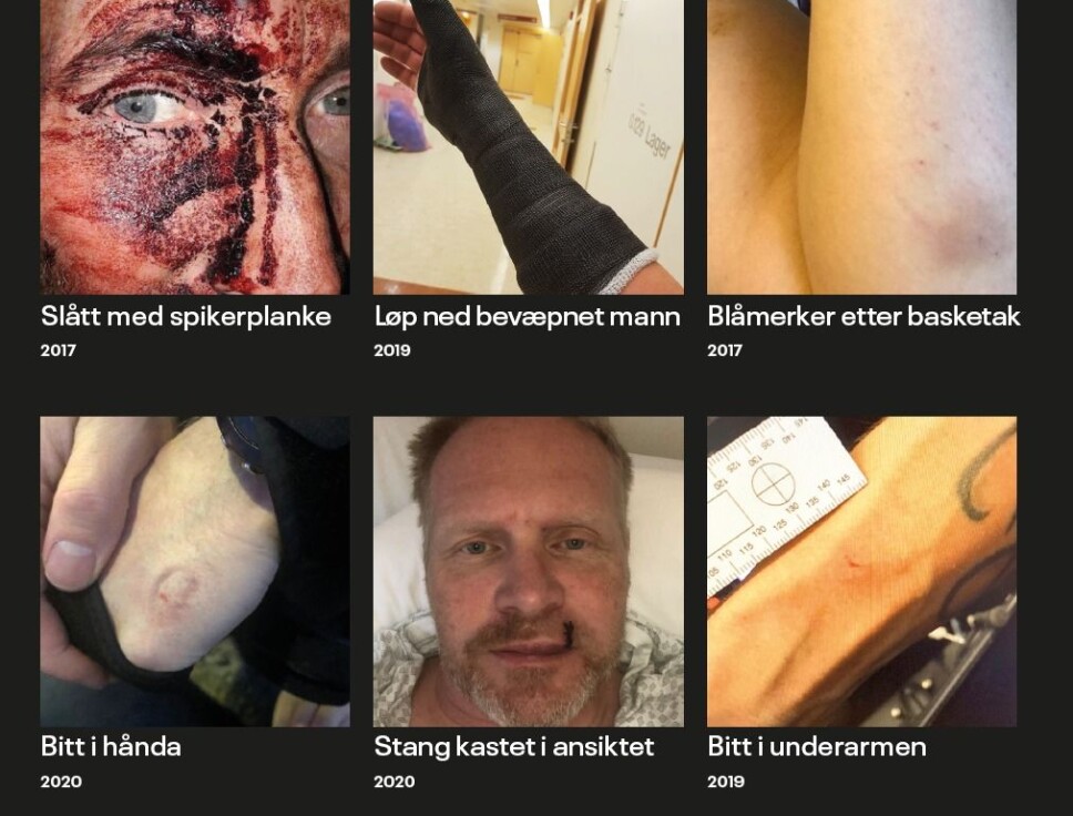 Her øker volden mot politiet mest