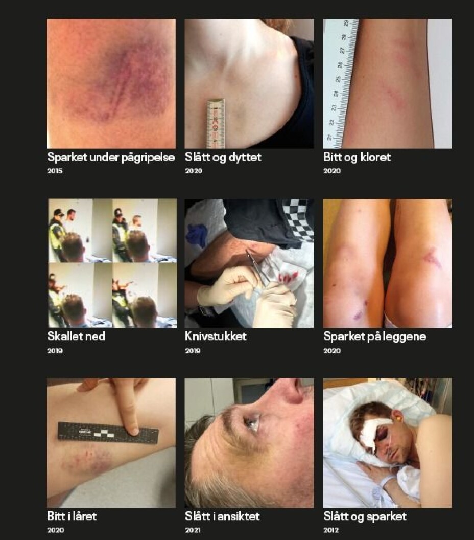 Her øker volden mot politiet mest