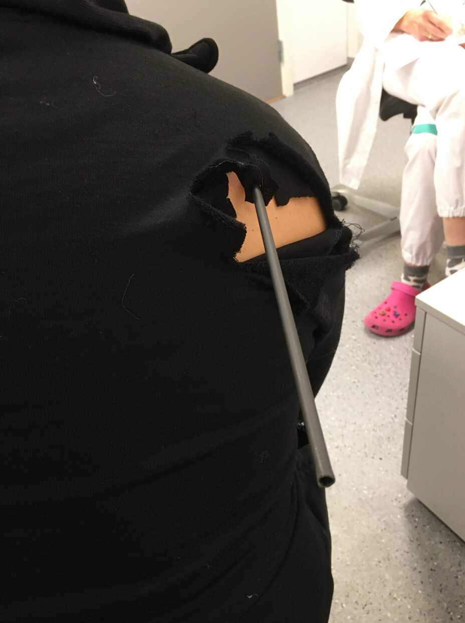 Politimannen Rigoberto Villarroel ble skutt i ryggen med pil og bue, da han forsøkte å få folk ut av butikken hvor gjerningsmannen var. Politimannen Rigoberto Villarroel ble skutt i ryggen med pil og bue, da han forsøkte å få folk ut av butikken hvor gjerningsmannen var.