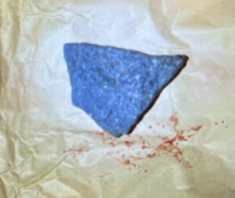 Steinen som polititjenestemannen ble slått i hodet med.